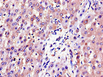 Immunofluorescent analysis of A549 cells using CAC14579 at dilution of 1:100 and Alexa Fluor 488-congugated AffiniPure Goat Anti-Rabbit IgG(H+L)