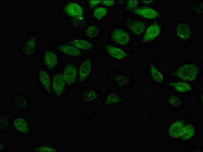 AKR1B1 Polyclonal Antibody - image 4