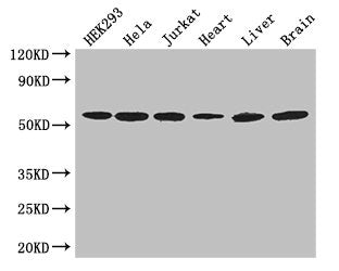 Immunohistochemistry of paraffin-embedded human lymph node tissue using CAC14580 at dilution of 1:100