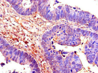 Immunofluorescent analysis of Hela cells using CAC14584 at dilution of 1:100 and Alexa Fluor 488-congugated AffiniPure Goat Anti-Rabbit IgG(H+L)