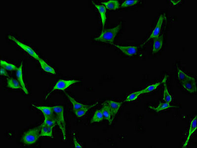CDC25B Polyclonal Antibody - image 4