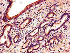 Immunofluorescent analysis of Hela cells using CAC14588 at dilution of 1:100 and Alexa Fluor 488-congugated AffiniPure Goat Anti-Rabbit IgG(H+L)