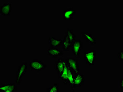 EPHB6 Polyclonal Antibody - image 4