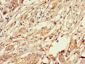 Immunofluorescent analysis of HepG2 cells using CAC14592 at dilution of 1:100 and Alexa Fluor 488-congugated AffiniPure Goat Anti-Rabbit IgG(H+L)