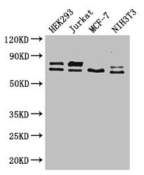Immunohistochemistry of paraffin-embedded human brain tissue using CAC14596 at dilution of 1:100