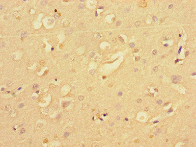Immunofluorescent analysis of Hela cells using CAC14596 at dilution of 1:100 and Alexa Fluor 488-congugated AffiniPure Goat Anti-Rabbit IgG(H+L)