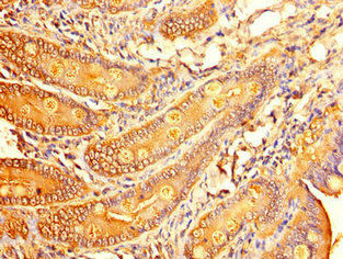 Immunohistochemistry of paraffin-embedded human brain tissue using CAC14607 at dilution of 1:100