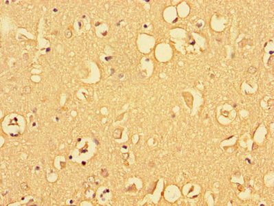 Immunofluorescent analysis of HepG2 cells using CAC14607 at dilution of 1:100 and Alexa Fluor 488-congugated AffiniPure Goat Anti-Rabbit IgG(H+L)