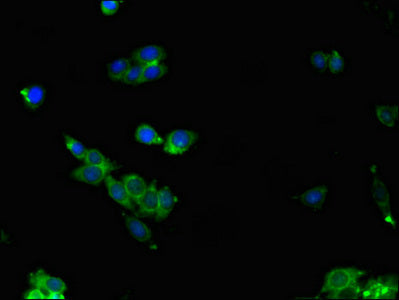 Western Blot, Positive WB detected in: Mouse brain tissue, Mouse skeletal muscle tissue, Mouse liver tissue, All lanes: ALDOC antibody at 3ug/ml, Secondary, Goat polyclonal to rabbit IgG at 1/50000 dilution, Predicted band size: 40 kDa, Observed band size: 40, 36, 42 kDa