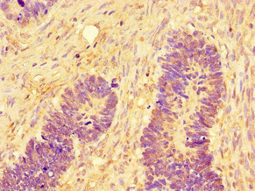 Immunofluorescent analysis of Hela cells using CAC14610 at dilution of 1:100 and Alexa Fluor 488-congugated AffiniPure Goat Anti-Rabbit IgG(H+L)