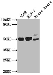 SRGAP2B Polyclonal Antibody - image 4