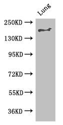 Immunofluorescent analysis of Hela cells using CAC14612 at dilution of 1:100 and Alexa Fluor 488-congugated AffiniPure Goat Anti-Rabbit IgG(H+L)