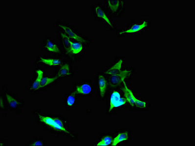 TSC2 Polyclonal Antibody - image 3