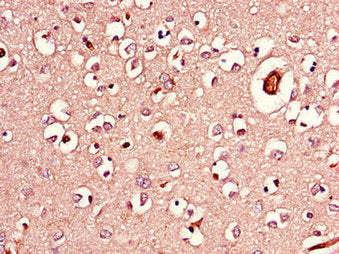 Immunohistochemistry of paraffin-embedded human kidney tissue using CAC14616 at dilution of 1:100