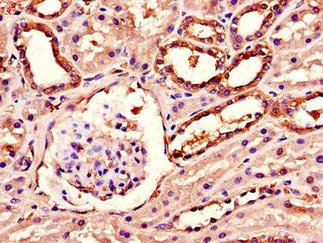 AGK Polyclonal Antibody - image 4