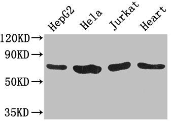 Immunohistochemistry of paraffin-embedded human endometrial cancer using CAC14620 at dilution of 1:100
