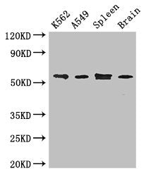 Immunofluorescent analysis of HepG2 cells using CAC14627 at dilution of 1:100 and Alexa Fluor 488-congugated AffiniPure Goat Anti-Rabbit IgG(H+L)