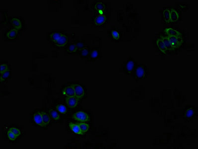 CORO1C Polyclonal Antibody - image 3