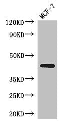 Western Blot, Positive WB detected in: K562 whole cell lysate, Jurkat whole cell lysate, 293T whole cell lysate, All lanes: ADIPOR1 antibody at 1:2500, Secondary, Goat polyclonal to rabbit IgG at 1/50000 dilution, Predicted band size: 43 kDa, Observed band size: 43 kDa