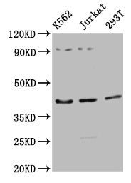 Immunohistochemistry of paraffin-embedded human liver tissue using CAC14629 at dilution of 1:100