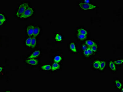 ADIPOR1 Polyclonal Antibody - image 5