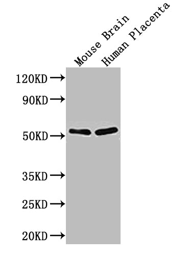 Immunohistochemistry of paraffin-embedded human heart tissue using CAC14630 at dilution of 1:100