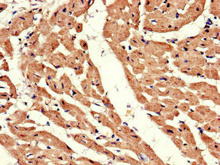 Immunofluorescent analysis of HepG2 cells using CAC14630 at dilution of 1:100 and Alexa Fluor 488-congugated AffiniPure Goat Anti-Rabbit IgG(H+L)