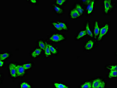 ADRB1 Polyclonal Antibody - image 4