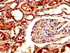 Immunofluorescent analysis of Hela cells using CAC14631 at dilution of 1:100 and Alexa Fluor 488-congugated AffiniPure Goat Anti-Rabbit IgG(H+L)
