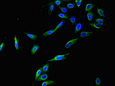 Immunohistochemistry of paraffin-embedded human gastric cancer using CAC14633 at dilution of 1:100