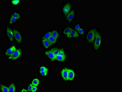 CDH2 Polyclonal Antibody - image 3
