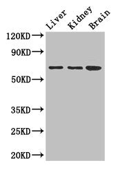 Immunohistochemistry of paraffin-embedded human brain tissue using CAC14673 at dilution of 1:100