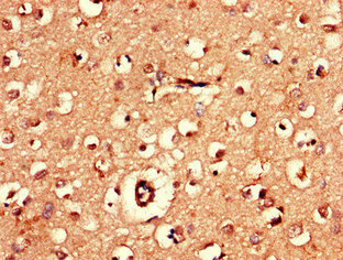 Immunofluorescent analysis of HepG2 cells using CAC14673 at dilution of 1:100 and Alexa Fluor 488-congugated AffiniPure Goat Anti-Rabbit IgG(H+L)