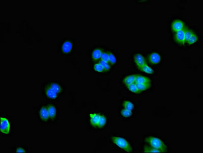 AK5 Polyclonal Antibody - image 4