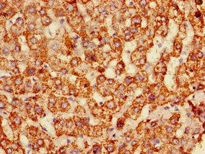 ALDH6A1 Polyclonal Antibody - image 3