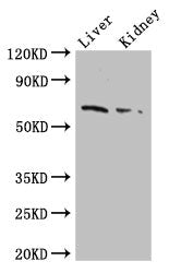 IHC image of CAC14684 diluted at 1:500 and staining in paraffin-embedded human thyroid tissue performed on a Leica BondTM system. After dewaxing and hydration, antigen retrieval was mediated by high pressure in a citrate buffer (pH 6.0). Section was blocked with 10% normal goat serum 30min at RT. Then primary antibody (1% BSA) was incubated at 4°C overnight. The primary is detected by a biotinylated secondary antibody and visualized using an HRP conjugated SP system.