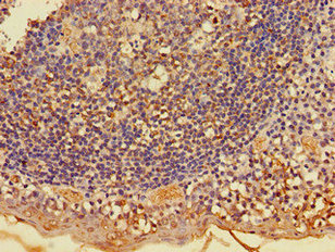 Immunohistochemistry of paraffin-embedded human testis tissue using CAC14694 at dilution of 1:100