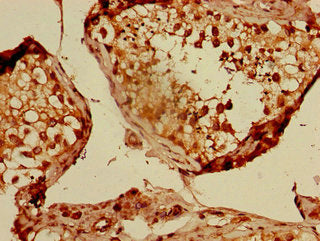 CUL2 Polyclonal Antibody - image 3