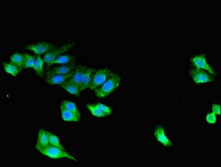 Western Blot, Positive WB detected in: PC-3 whole cell lysate, HepG2 whole cell lysate, Mouse brain tissue, All lanes: STAC antibody at 3ug/ml, Secondary, Goat polyclonal to rabbit IgG at 1/50000 dilution, Predicted band size: 45 kDa, Observed band size: 45 kDa