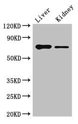Immunofluorescent analysis of U251 cells using CAC14700 at dilution of 1:100 and Alexa Fluor 488-congugated AffiniPure Goat Anti-Rabbit IgG(H+L)