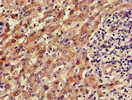 Immunohistochemistry of paraffin-embedded human kidney tissue using CAC14703 at dilution of 1:100