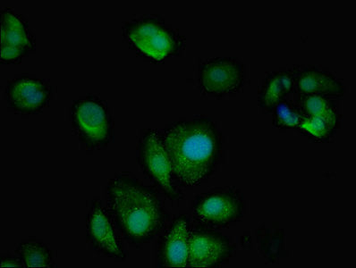 Western Blot, Positive WB detected in: U87 whole cell lysate, All lanes: AMPD2 antibody at 3ug/ml, Secondary, Goat polyclonal to rabbit IgG at 1/50000 dilution, Predicted band size: 101, 93, 89 kDa, Observed band size: 101 kDa