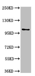 AMPD2 Polyclonal Antibody - image 4