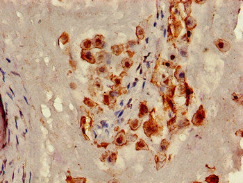 Immunohistochemistry of paraffin-embedded human lung tissue using CAC14710 at dilution of 1:100