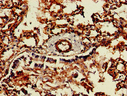 Immunofluorescent analysis of A549 cells using CAC14710 at dilution of 1:100 and Alexa Fluor 488-congugated AffiniPure Goat Anti-Rabbit IgG(H+L)