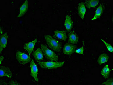 Western Blot, Positive WB detected in: HepG2 whole cell lysate, PC-3 whole cell lysate, All lanes: CAV2 antibody at 3ug/ml, Secondary, Goat polyclonal to rabbit IgG at 1/50000 dilution, Predicted band size: 19, 17, 13 kDa, Observed band size: 19 kDa