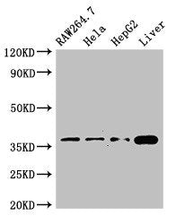 Immunohistochemistry of paraffin-embedded human lung tissue using CAC14712 at dilution of 1:100