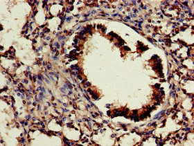 Immunohistochemistry of paraffin-embedded human brain tissue using CAC14712 at dilution of 1:100
