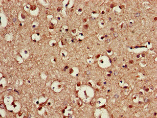 CDX4 Polyclonal Antibody - image 4