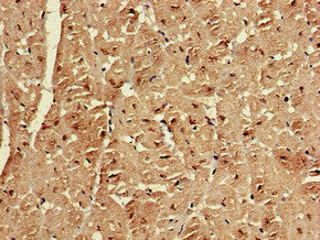Immunohistochemistry of paraffin-embedded human bladder cancer using CAC14721 at dilution of 1:100